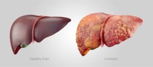 Anatomy Lesson #49, “Our Liver – The Life Giver!” – GI Tract 6 ...